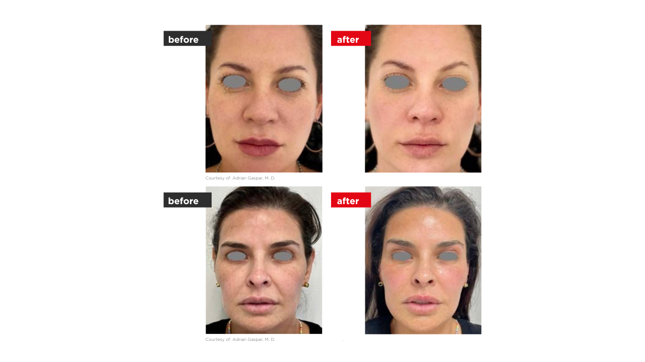 VectorLift elotte utana